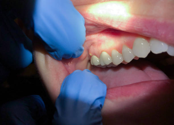 Best Pediatric Emergency Dentist in Keyser, WV